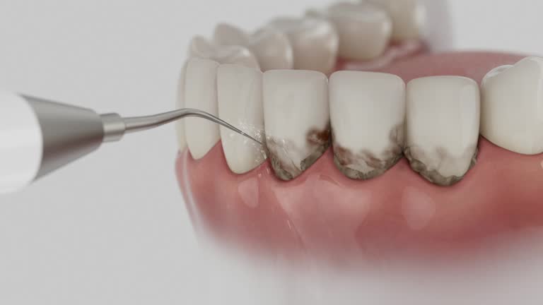 Trusted Wisdom Tooth Removal service in Mountain Top, PA - Dentist Open Now